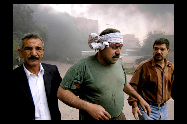 A victim is escorted from the scene of a garbage truck explosion in Baghdad