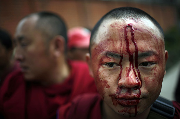 Blood flows from the forehead of a Tibetan monk beaten by police during a peace rally in Kathmandu, Nepal.