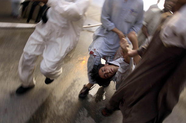 A wounded man in Pakistan