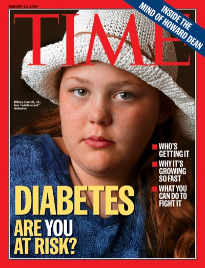 A photograph of a young girl with Diabetes