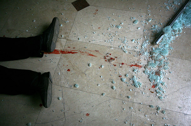 The dead body of a journalist lies on the ground after being brought into a pharmacy. The reporter and his driver were hit by a Russian shell in Stalin square, in Gori, Georgia.