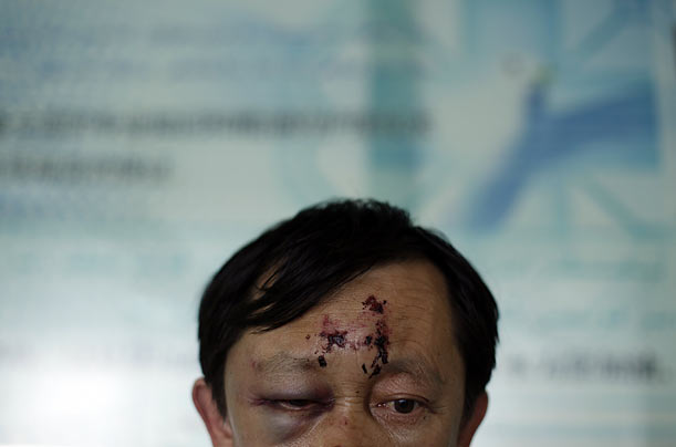Huan Chen Jiang is treated for injuries sustained during riots in Urumqi, Xinjiang province, China.
